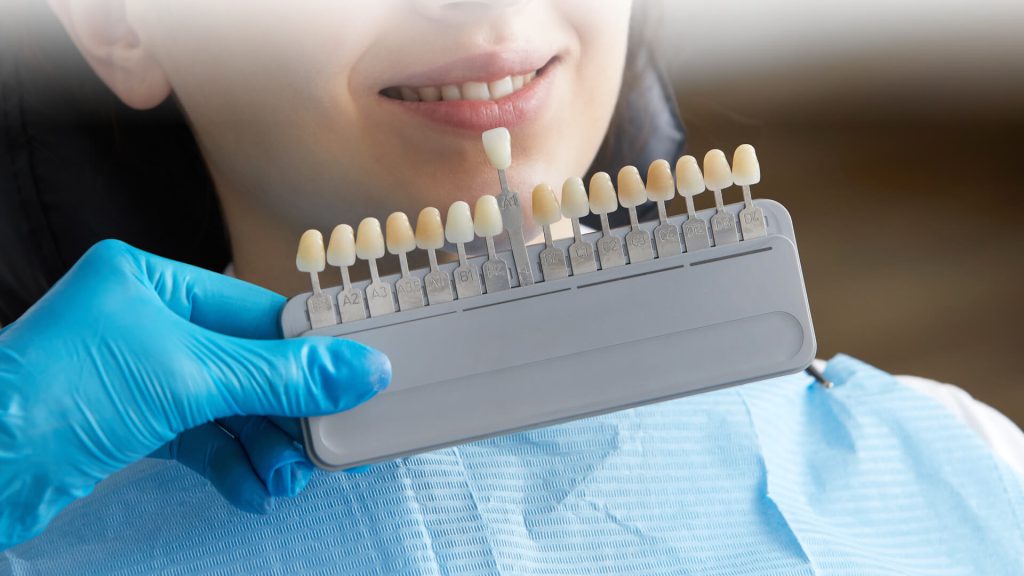 Teeth Whitening in Perth